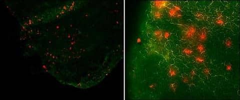 Kaede-red cells (= cells migrating from the skin) in the draining LNs